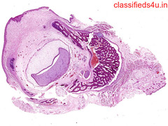 Digi Scan pathology provides best histology digital slides 