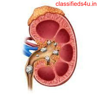 Super Speciality Kidney Hospital In Bangalore