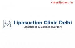  Liposuction Clinic in Delhi, weight loss Surgery in India
