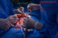 Open Heart Surgery in Delhi by Dr. Sujay Shad