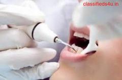 Scaling and Polishing Teeth Doctors