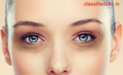 Most Efficient Dark Circle Treatment in Ludhiana at Bliss Laser Skin Clinic