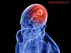 Embark on Your Journey to Excellence with Top-Notch Brain Tumor Treatment in UP