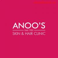 Advanced Skin Tightening treatment at ANOOS